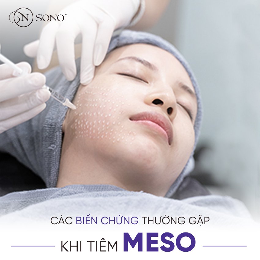 Mesotherapy là gì? Các biến chứng thường gặp