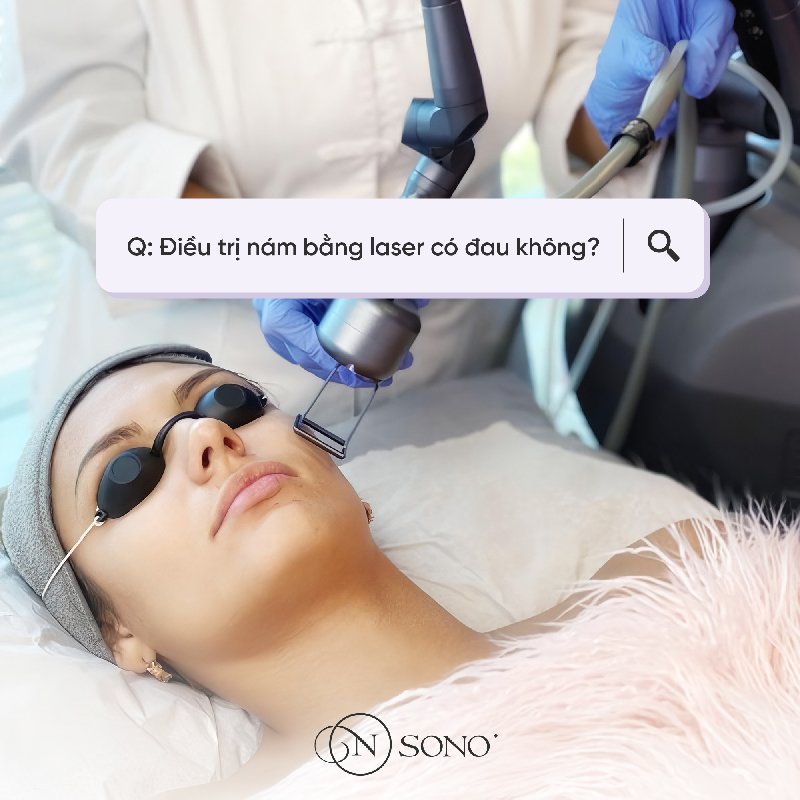 Điều trị nám bằng laser có đau không?