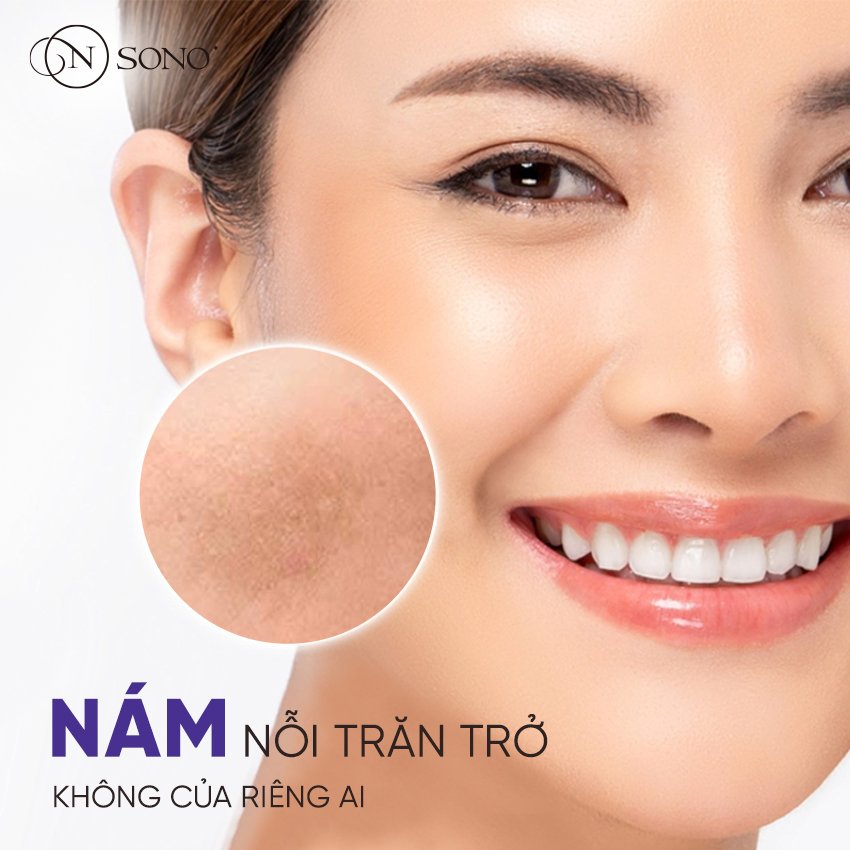 Nám da - Nỗi trăn trở không của riêng ai